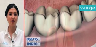 როგორ გავაქროთ უსიამოვნო სუნი პირის ღრუდან. რჩევა რომელიც ყველას გჭირდებათ!