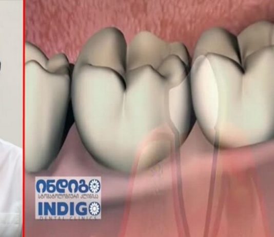 როგორ გავაქროთ უსიამოვნო სუნი პირის ღრუდან. რჩევა რომელიც ყველას გჭირდებათ!