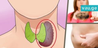 ფარისებრი ჯირკვლის დაავადებების სიმპტომები. საჭირო ინფორმაცია, რომელიც ბევრს გამოადგება