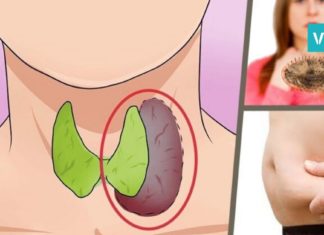 ფარისებრი ჯირკვლის დაავადებების სიმპტომები. საჭირო ინფორმაცია, რომელიც ბევრს გამოადგება