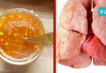 როგორ გავწმინდოთ ფილტვები? ელექსირის რეცეპტი, რომელიც მწეველებს გამოადგებათ