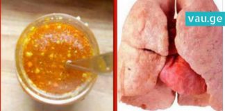 როგორ გავწმინდოთ ფილტვები? ელექსირის რეცეპტი, რომელიც მწეველებს გამოადგებათ