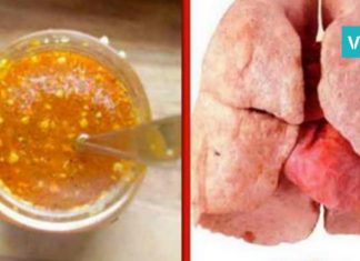 როგორ გავწმინდოთ ფილტვები? ელექსირის რეცეპტი, რომელიც მწეველებს გამოადგებათ