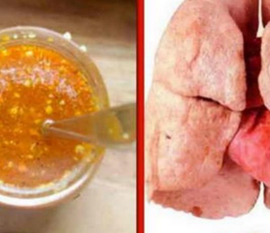 როგორ გავწმინდოთ ფილტვები? ელექსირის რეცეპტი, რომელიც მწეველებს გამოადგებათ