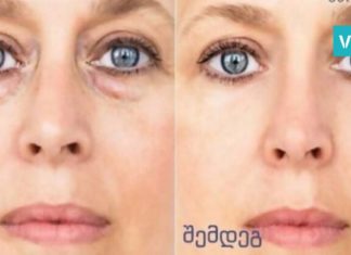 7 რჩევა, რომლებიც თვალების ირგვლივ სიშავესა და შეშუპებას მოგაცილებთ.. გაახალგაზრდავდით!