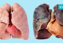 ეწევით? მაშინ ეს 4 რჩევა თქვენთვისაა. გაიწმინდეთ ფილტვები სწრაფად და მარტივად