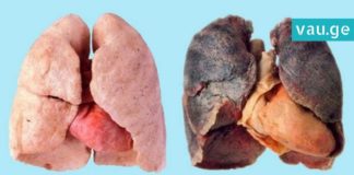 ეწევით? მაშინ ეს 4 რჩევა თქვენთვისაა. გაიწმინდეთ ფილტვები სწრაფად და მარტივად