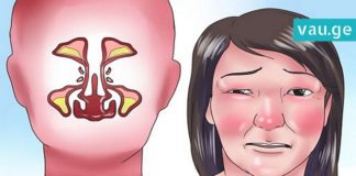 ცხვირის გაჭედილობის შეგრძნება გაქვთ? მაშინ ეს მეთოდი გამოგადგებათ. ეფექტურია!