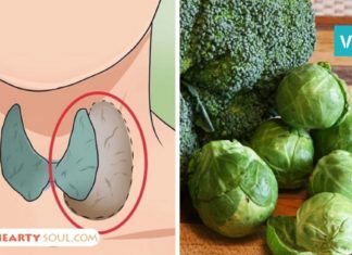 რა დიეტა უნდა დავიცვათ ფარისებრი ჯირკვლის დაავადებების დროს? საჭირო ინფორმაციაა