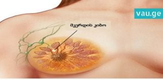 2 ინგრედიენტი, რომელსაც მკერდის კიბოს განკურნება შეუძლია. მეცნიერების ახალი აღმოჩენა