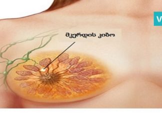 2 ინგრედიენტი, რომელსაც მკერდის კიბოს განკურნება შეუძლია. მეცნიერების ახალი აღმოჩენა