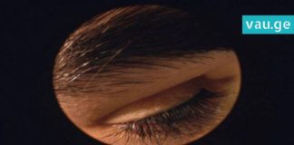 საშინელი პარაზიტები, რომლებიც ყველა ადამიანის სახეზე ცხოვრობენ! მათი ნახვა შემზარავია!