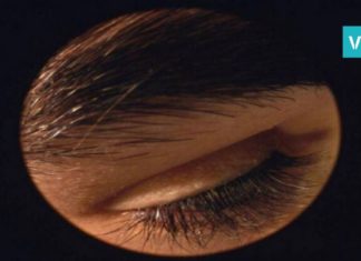 საშინელი პარაზიტები, რომლებიც ყველა ადამიანის სახეზე ცხოვრობენ! მათი ნახვა შემზარავია!