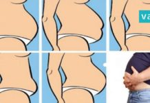 5 ტიპის მუცელი და მათი მოშორების მეთოდები… წაიკითხე და გაილამაზე შენი ცხოვრება!