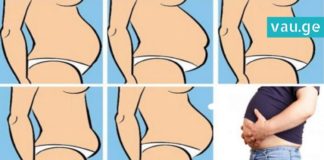 5 ტიპის მუცელი და მათი მოშორების მეთოდები… წაიკითხე და გაილამაზე შენი ცხოვრება!