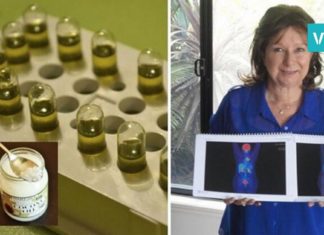 ეს ქალი ქოქოსის და კანაფის ზეთს სვამდა, რამდენიმე თვეში კი აი, ეს დაემართა