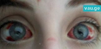 ბიჭმა მხედველობის 75% აი, ამ სათამაშოს გამო დაკარგა. მშობლებო, ყურადღებით იყავით