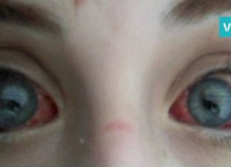 ბიჭმა მხედველობის 75% აი, ამ სათამაშოს გამო დაკარგა. მშობლებო, ყურადღებით იყავით