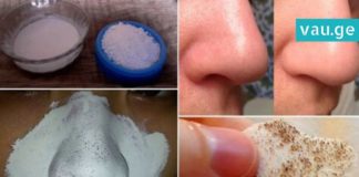 ამ ორმა პროდუქტმა შავი წერტილები სამუდამოდ გამიქრო – ნახეთ როგორ დაამზადოთ სასაწაულმოქმედი ნიღაბი