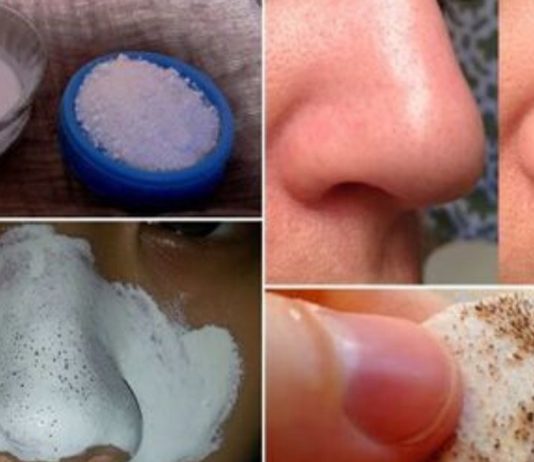 ამ ორმა პროდუქტმა შავი წერტილები სამუდამოდ გამიქრო – ნახეთ როგორ დაამზადოთ სასაწაულმოქმედი ნიღაბი