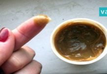 ართროზისა და სახსრების ტკივილის მკურნალობა ხალხური რეცეპტების საშუალებით.. ამოვისუნთქე!