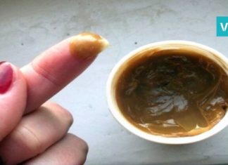 ართროზისა და სახსრების ტკივილის მკურნალობა ხალხური რეცეპტების საშუალებით.. ამოვისუნთქე!