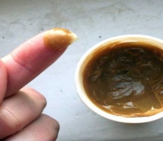 ართროზისა და სახსრების ტკივილის მკურნალობა ხალხური რეცეპტების საშუალებით.. ამოვისუნთქე!