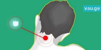 აი, რა მოხდება თუ კისერს ყინულს მიადებთ. მეთოდი, რომელიც უკვე ბევრმა სცადა