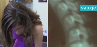 გოგონას კისრის არეში ქრონიკული ტკივილი აწუხებდა. დიაგნოზმა მისი მშობლები შეაშფოთა!