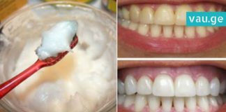 უახლესი კვლევების შედეგი: ქოქოსის კარაქი, რომელსაც კბილის პასტაზე უკეთესი შედეგი აქვს