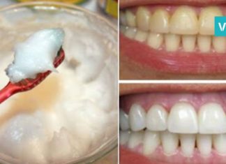 უახლესი კვლევების შედეგი: ქოქოსის კარაქი, რომელსაც კბილის პასტაზე უკეთესი შედეგი აქვს