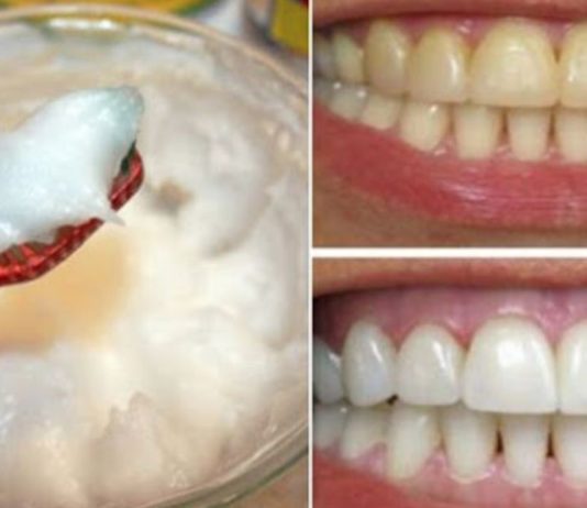 უახლესი კვლევების შედეგი: ქოქოსის კარაქი, რომელსაც კბილის პასტაზე უკეთესი შედეგი აქვს