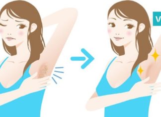 როგორ ავირიდოთ თავიდან იღლიის სიმუქე და სიყვითლე? ყველაზე ეფექტური ხერხები