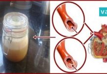 რა უნდა გააკეთოთ იმისთვის, რომ წნევა მუდამ დარეგულირებული გქონდეთ? ეფექტურია