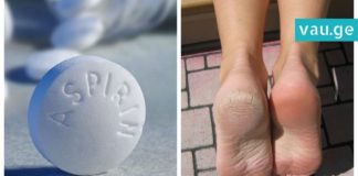 ეს წამალი მშრალ და დახეთქილ ფეხებს 10 დღეში კურნავს! ნეტავ ადრე მცოდნოდა !