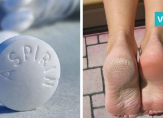 ეს წამალი მშრალ და დახეთქილ ფეხებს 10 დღეში კურნავს! ნეტავ ადრე მცოდნოდა !