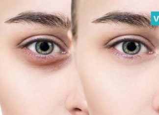 თვალების გარშემო შავი წრეების მოშორება ასე ადვილი ჯერ არ ყოფილა. იდეალური გამოსავალია