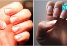 გრძელი, ჯანმრთელი და თეთრი ფრჩხილები. რეცეპტი, რომელიც უკვე ბევრმა ადამიანმა გამოიყენა!