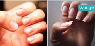 გრძელი, ჯანმრთელი და თეთრი ფრჩხილები. რეცეპტი, რომელიც უკვე ბევრმა ადამიანმა გამოიყენა!