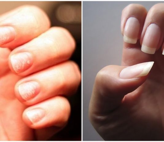 გრძელი, ჯანმრთელი და თეთრი ფრჩხილები. რეცეპტი, რომელიც უკვე ბევრმა ადამიანმა გამოიყენა!