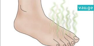 როგორ უნდა მოიშოროთ უსიამოვნო სუნი ფეხიდან? ყველაზე სწრაფი და ეფექტური ხერხი