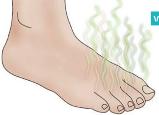 როგორ უნდა მოიშოროთ უსიამოვნო სუნი ფეხიდან? ყველაზე სწრაფი და ეფექტური ხერხი