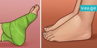 დაიდეთ კომბოსტოს ფოთლები ასე და გათავისუფლდით ტკივილისგან! სასარგებლო რჩევები თქვენთვის