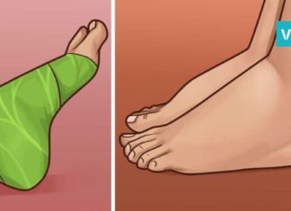 დაიდეთ კომბოსტოს ფოთლები ასე და გათავისუფლდით ტკივილისგან! სასარგებლო რჩევები თქვენთვის