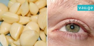 როგორ აღვიდგინოთ მხედველობა ნივრის მეშვეობით. არანაირი ოპერაცია!