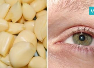 როგორ აღვიდგინოთ მხედველობა ნივრის მეშვეობით. არანაირი ოპერაცია!