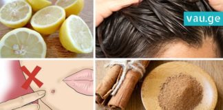 დაამარცხეთ ტკივილი, ანთება და ჭარბი წონა ლიმონისა და დარიჩინის გამოყენებით! ეფექტურია