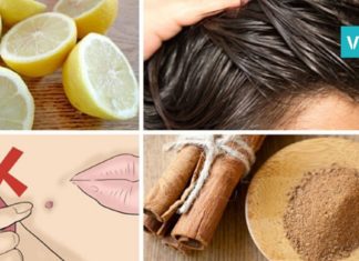 დაამარცხეთ ტკივილი, ანთება და ჭარბი წონა ლიმონისა და დარიჩინის გამოყენებით! ეფექტურია