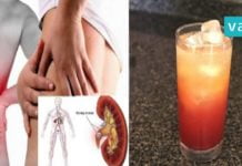 გემრიელი და სასარგებლო სასმელი თირკმელებში კენჭების წინააღმდეგ. ეფექტურია