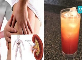 გემრიელი და სასარგებლო სასმელი თირკმელებში კენჭების წინააღმდეგ. ეფექტურია